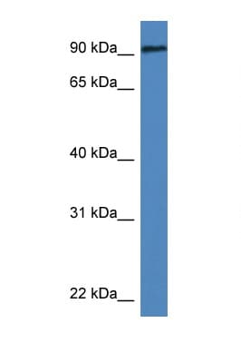 DLG3 / SAP102 Antibody (aa58-107)