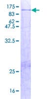 Human AOC2 / SSAO Protein (Recombinant GST)
