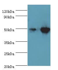 Polyclonal Rabbit anti-Human IDH2 Antibody (aa193-452, IHC, WB)