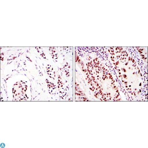 PRKDC / DNA-PKcs Antibody