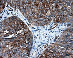 IFIT1 / ISG56 Antibody (clone OTI3G8)