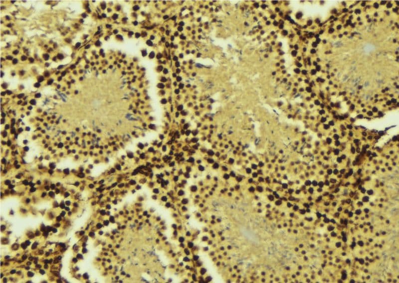 SARNP / Hcc-1 / CIP29 Antibody