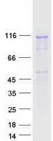 Human BAIAP3 Protein (Recombinant Myc-DDK (Flag))