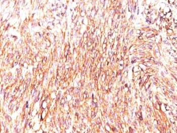 ANO1 / DOG1 / TMEM16A Antibody (aa904-986, clone DOG-1.1)
