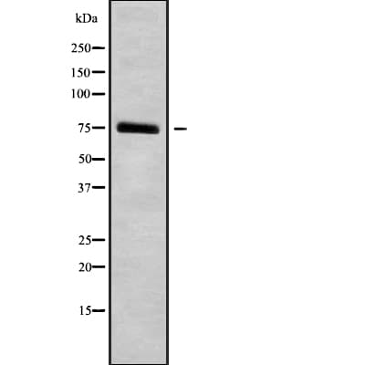 HGFAC / HGFA Antibody