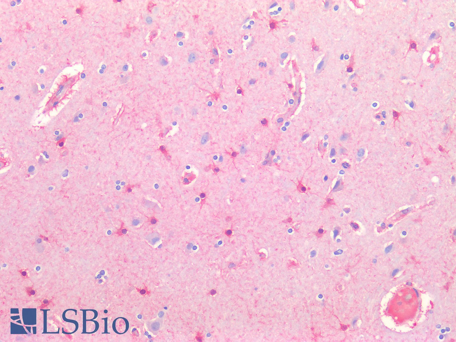 IHC-plus™ ERBB3 / HER3 Antibody (aa20-285)
