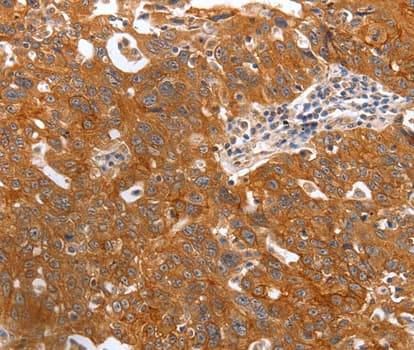 PGC / Pepsin C Antibody