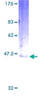 Human EDN2 / Endothelin 2 Protein (Recombinant GST)