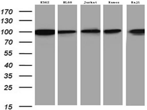 Monoclonal Mouse anti-Human MCM2 Antibody (clone UMAB238, IHC, WB)