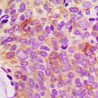 OPG / Osteoprotegerin Antibody (N-Terminus)