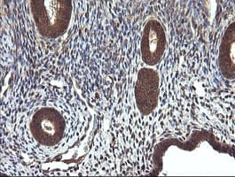 CTAG1B / NY-ESO-1 Antibody (clone OTI4C12)