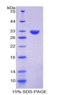 Chicken SPTAN1 / Alpha Fodrin Protein (Recombinant His)