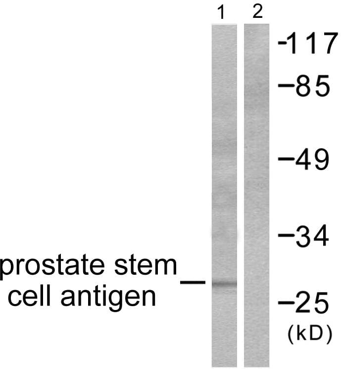 Polyclonal Rabbit anti-Human PSCA Antibody (WB)