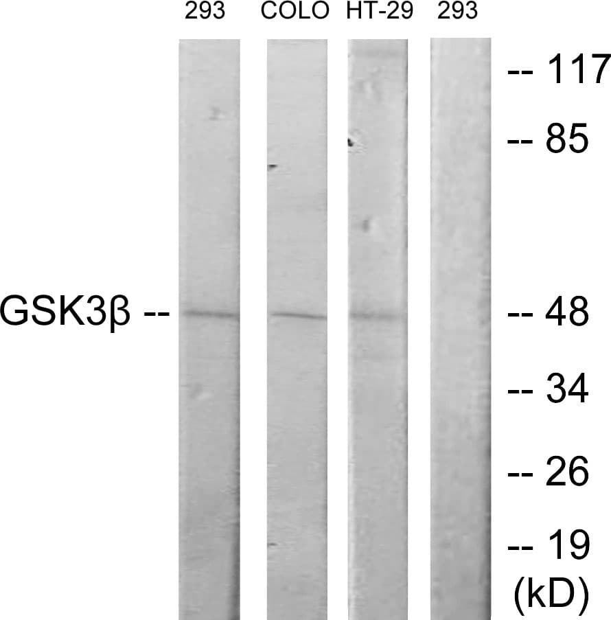 IHC-plus™ Polyclonal Rabbit anti-Human GSK3B / GSK3 Beta Antibody (aa1-50, IHC, WB)