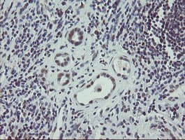 ZBED1 / TRAMP Antibody (clone OTI5A2)
