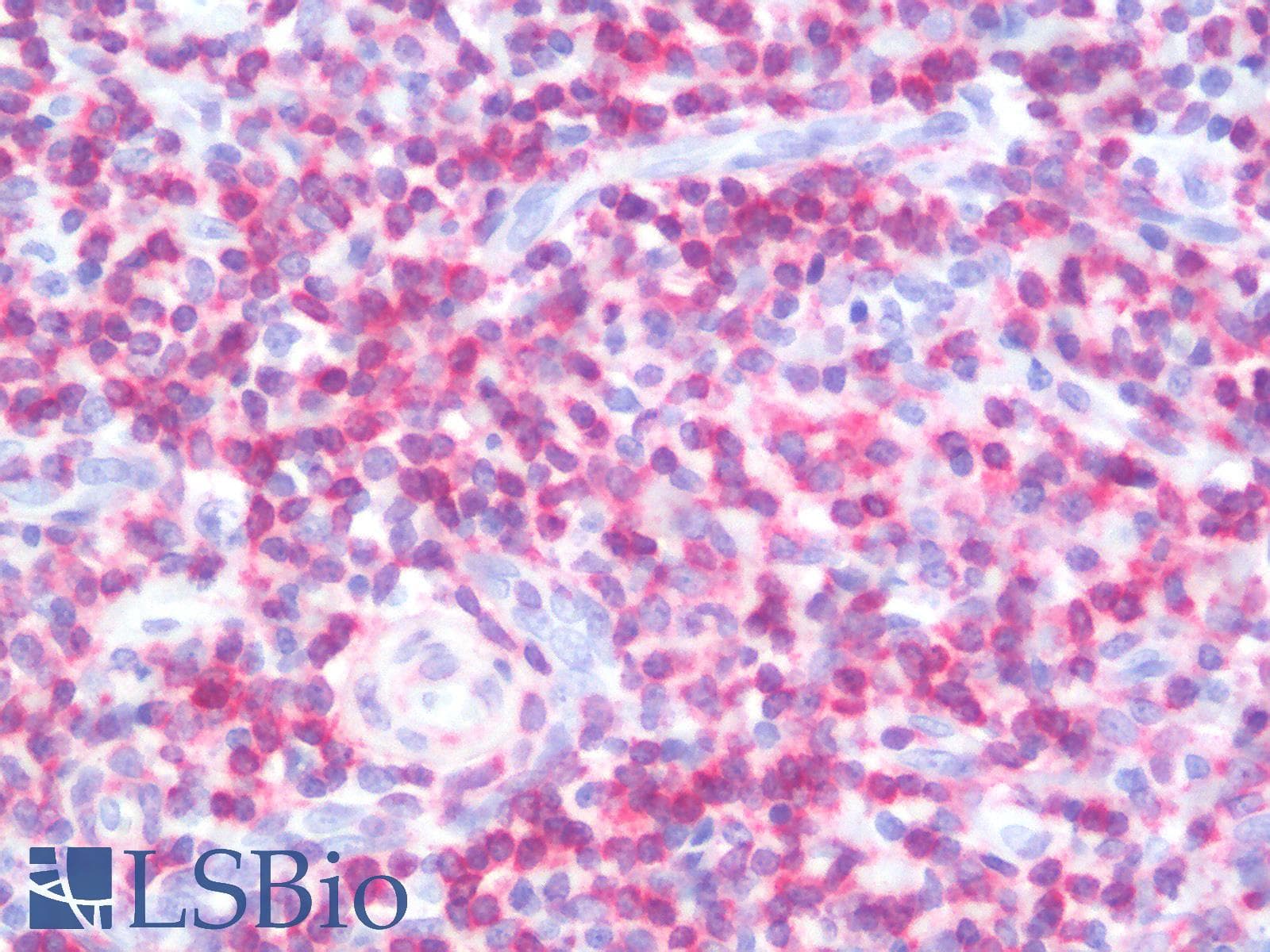PathPlus™ BCL2 / Bcl-2 Antibody (clone rBCL2/796)