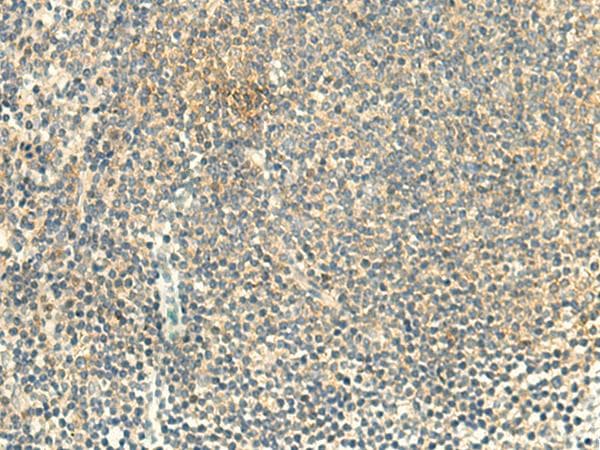 Polyclonal Rabbit anti-Human ALPK1 Antibody (IHC)