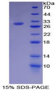 Mouse F11 / FXI / Factor XI Protein (Recombinant His-T7)