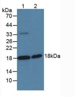 SPINT2 / HAI-2 Antibody (aa28-197, Biotin)