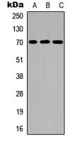 IL2RB / CD122 Antibody (phospho-Tyr364)