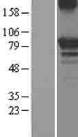 OS9 Protein (Over-Expression Lysate Myc-DDK (Flag))