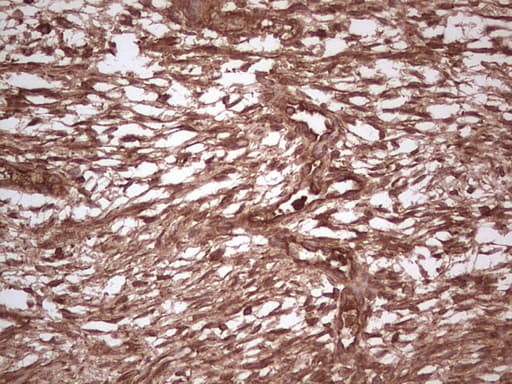 UBE2D2 / UBCH5B Antibody (clone OTI1D11)