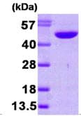 Human NDRG1 Protein (Recombinant His)