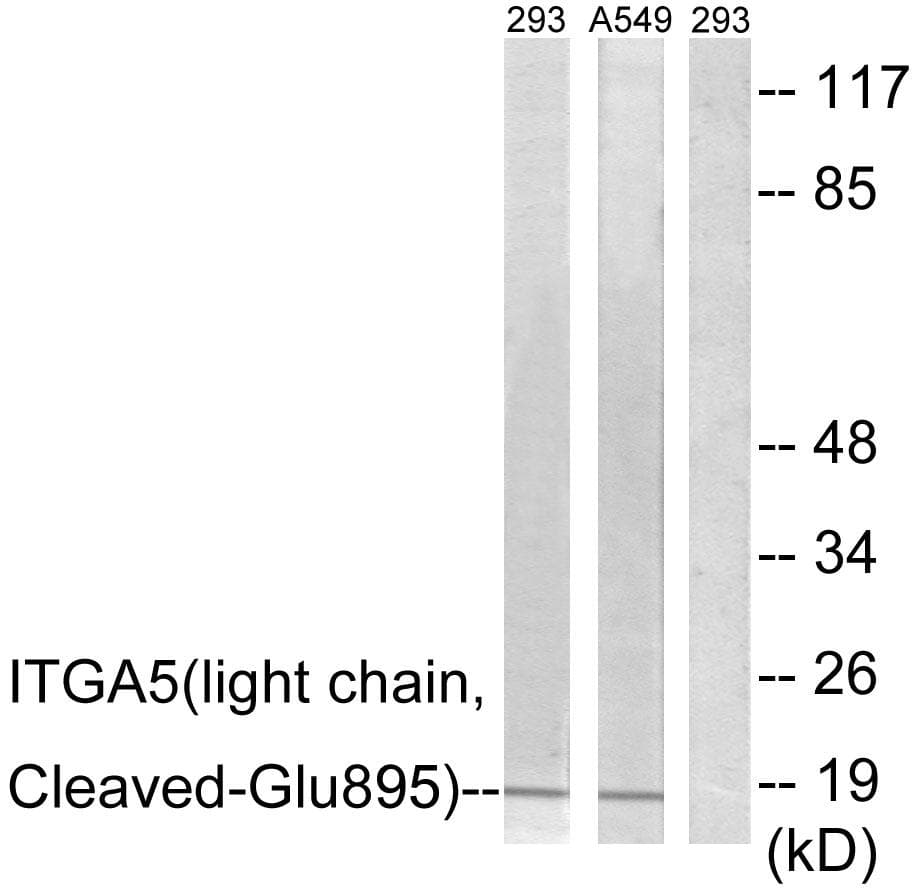 Polyclonal Rabbit anti-Human ITGA5/Integrin Alpha 5/CD49e Antibody (light chain, Cleaved-Glu895, WB)