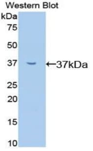 RELA / NFKB p65 Antibody (aa19-306)