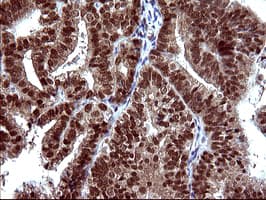 UPRT Antibody (clone OTI2D1)