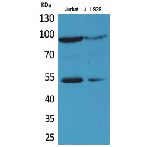 Polyclonal Rabbit anti-Human HIF2A / EPAS1 Antibody (380-420 aa, IHC, IF, WB)