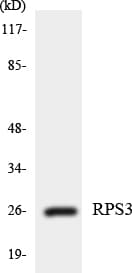 RPS3 / Ribosomal Protein S3 Antibody (aa160-209)