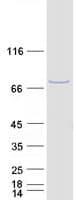 Human LRCH4 Protein (Recombinant Myc-DDK (Flag))