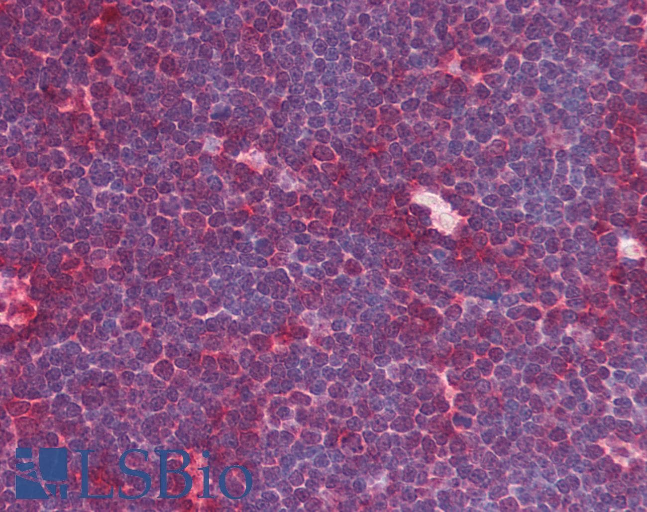 IHC-plus™ Monoclonal Mouse anti-Human MRE11A / MRE11 Antibody (clone 12D7, aa182-582, IHC, IF, WB)