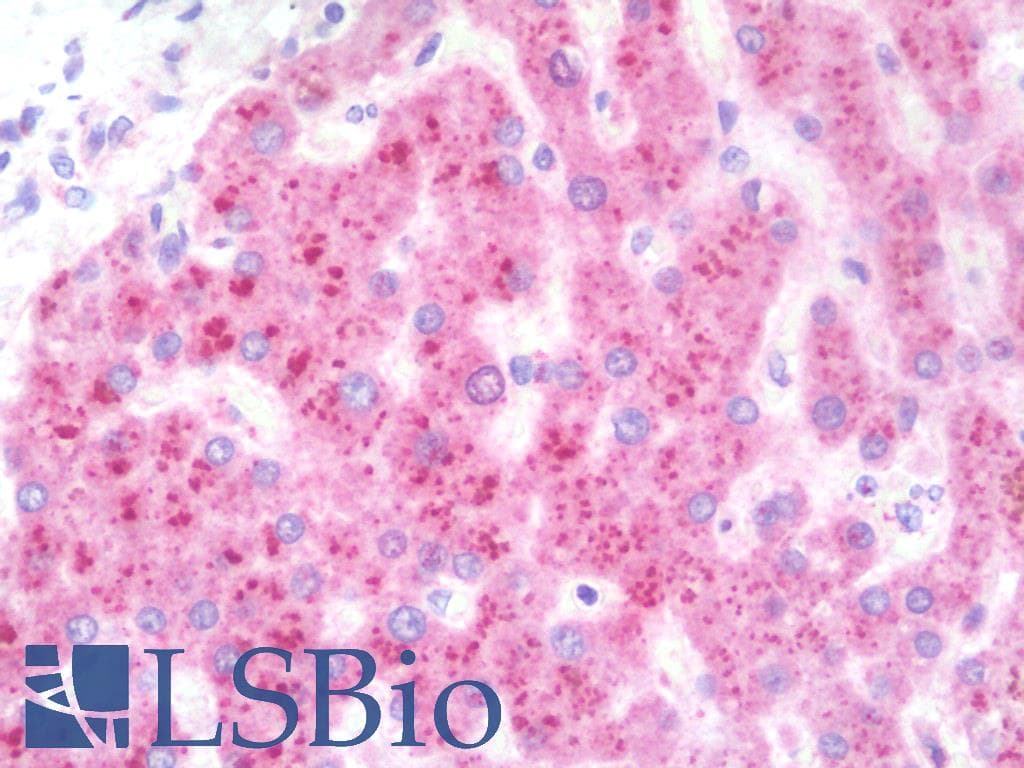 IHC-plus™ Polyclonal Rabbit anti-Human TMX3 Antibody (aa402-431, IHC, WB)
