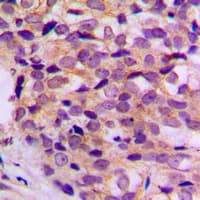 Polyclonal Rabbit anti-Human ATP5G1 / ATP5G Antibody (Internal, IHC, WB)