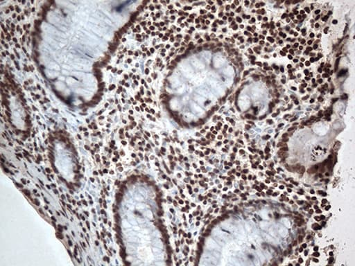 EWSR1 / EWS Antibody (aa256-447, clone OTI2G3)