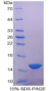 Human ACP1 / Acid Phosphatase Protein (Recombinant His)