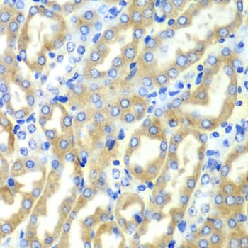 Polyclonal Rabbit anti-Human DDX1 Antibody (IHC, IF, WB)