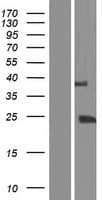 TGIF2LY Protein (Over-Expression Lysate Myc-DDK (Flag))