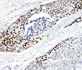 TP63 / p63 Antibody (aa664-680)