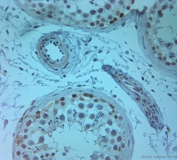SLC11A2 / DMT1 Antibody