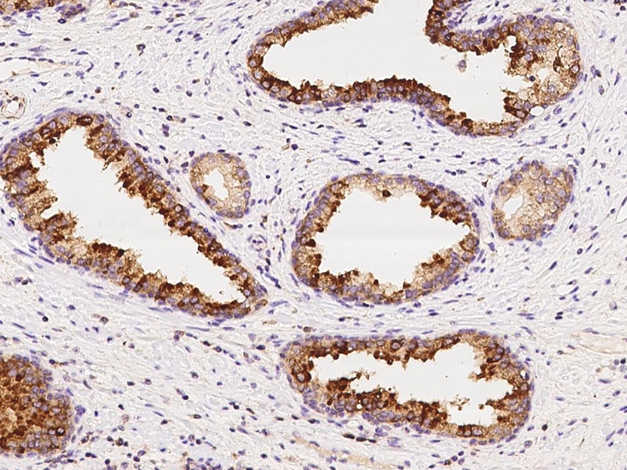 SLC39A6 / LIV-1 Antibody