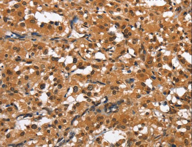 SLAMF8 Antibody