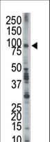 EPS8 Antibody (aa9-39)