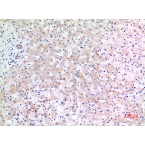 ALCAM / CD166 Antibody (481-530 aa, C-terminal)