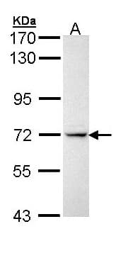 IL1R1 Antibody