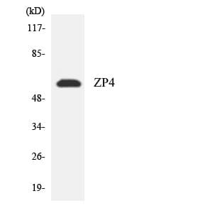 ZP4 / ZBP Antibody (aa218-267)