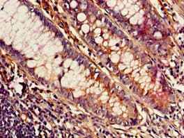 Polyclonal Rabbit anti-Human MED23 / SUR2 Antibody (IHC, IF)