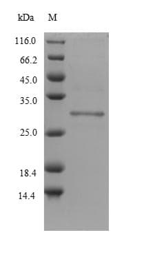 Mouse DLK2 Protein (Recombinant 6His, N-terminus)